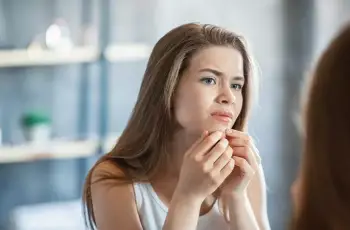 How to Get Rid of Acne: 8 Natural Treatments for Pimples